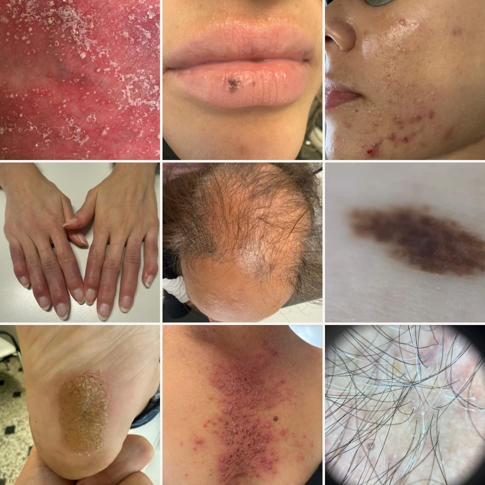 Dermatología Clínica